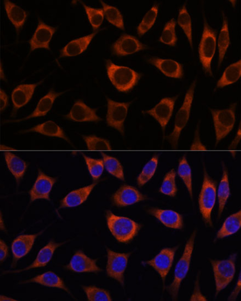 Immunofluorescence analysis of L929 cells using CTNNA3 Polyclonal Antibody at dilution of  1:100. Blue: DAPI for nuclear staining.