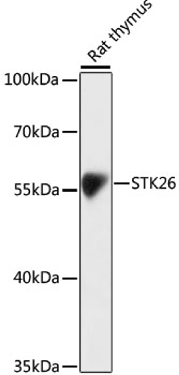 Western blot analysis of extracts of Rat thymus using STK26 Polyclonal Antibody at dilution of 1:1000.