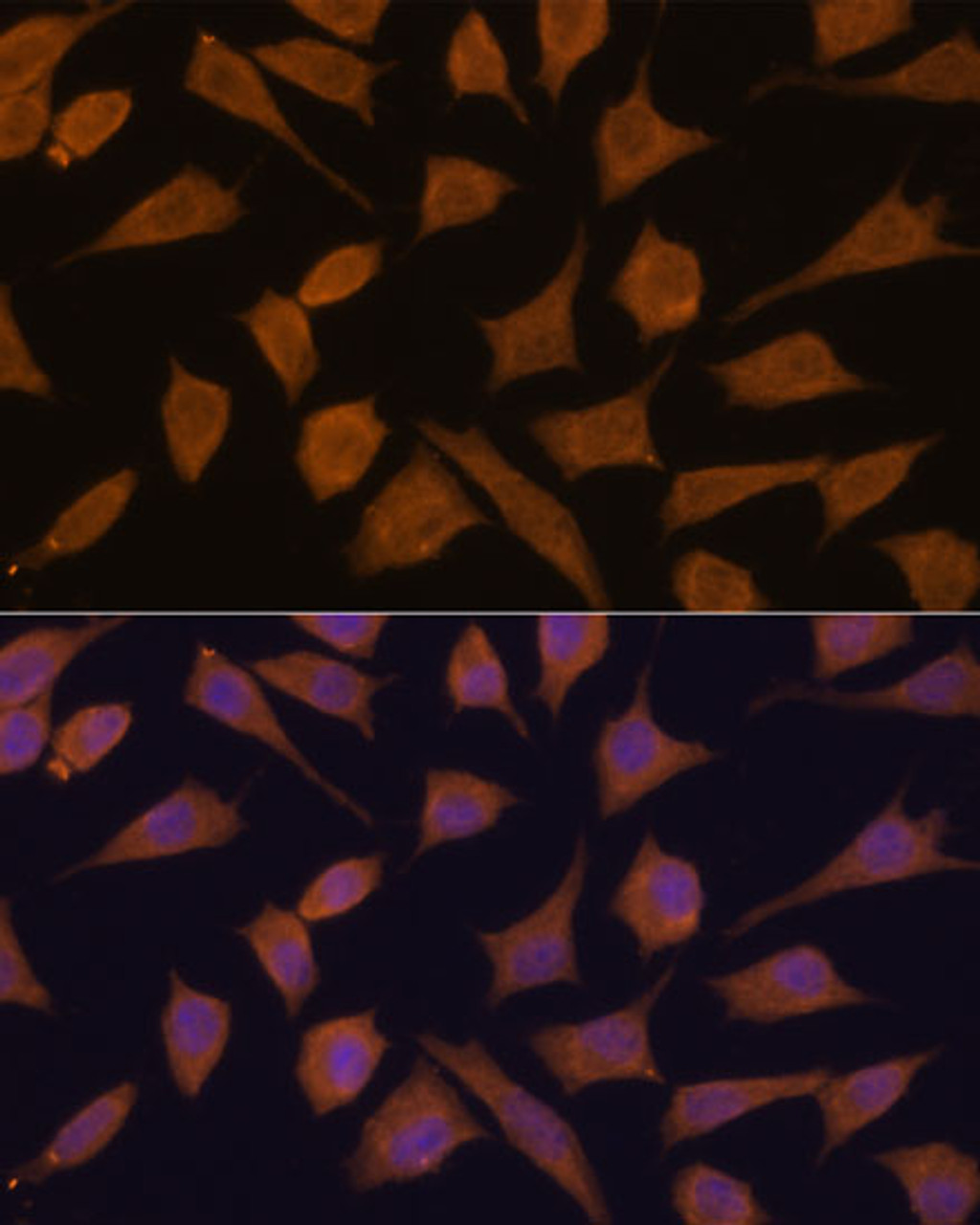 Immunofluorescence analysis of L929 cells using SEPT3 Polyclonal Antibody at dilution of  1:100. Blue: DAPI for nuclear staining.