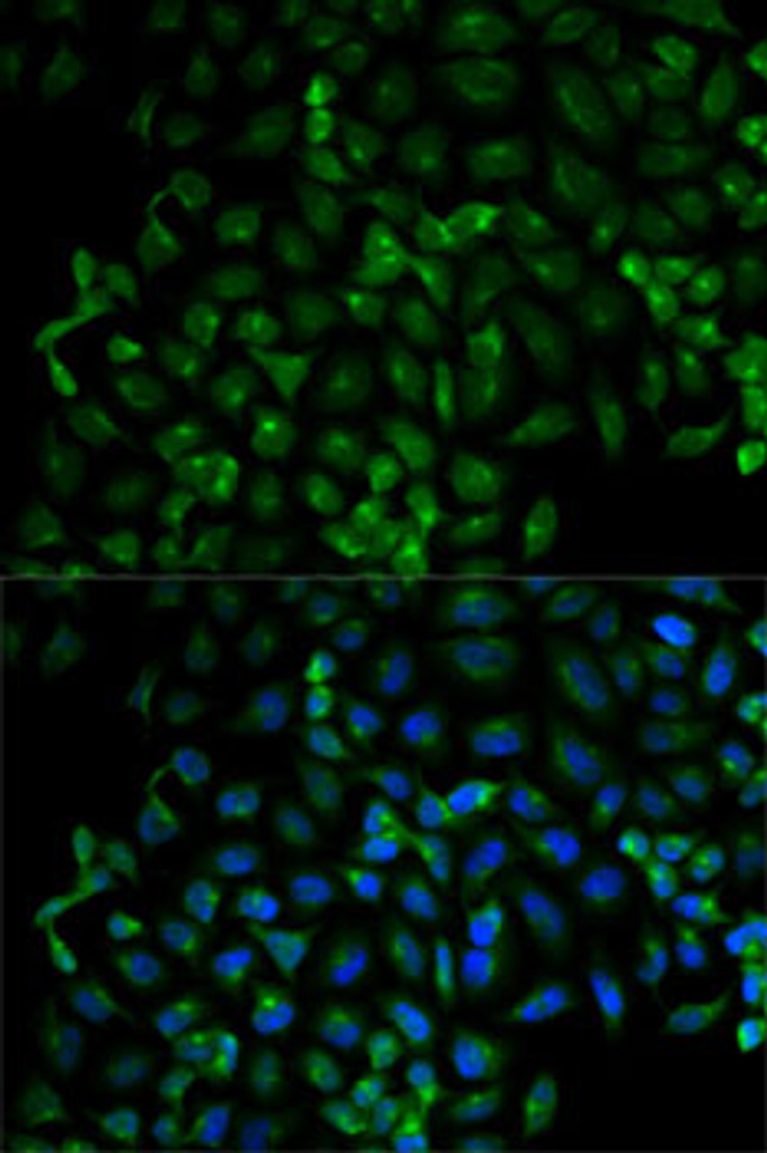 Immunofluorescence analysis of HeLa cells using Beta-TRCP Polyclonal Antibody