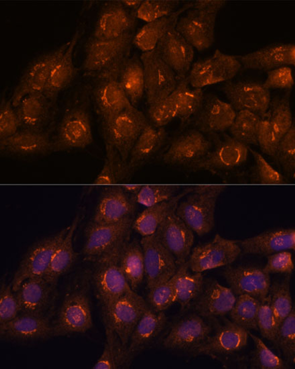 Immunofluorescence analysis of C6 cells using ACBD3 Polyclonal Antibody at dilution of  1:100. Blue: DAPI for nuclear staining.