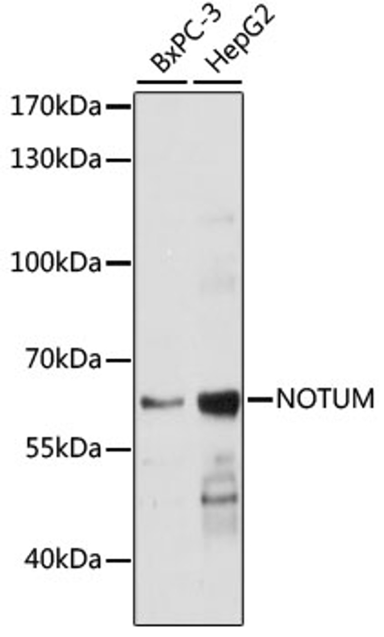 Western blot analysis of extracts of various cell lines using NOTUM Polyclonal Antibody at dilution of 1:1000.