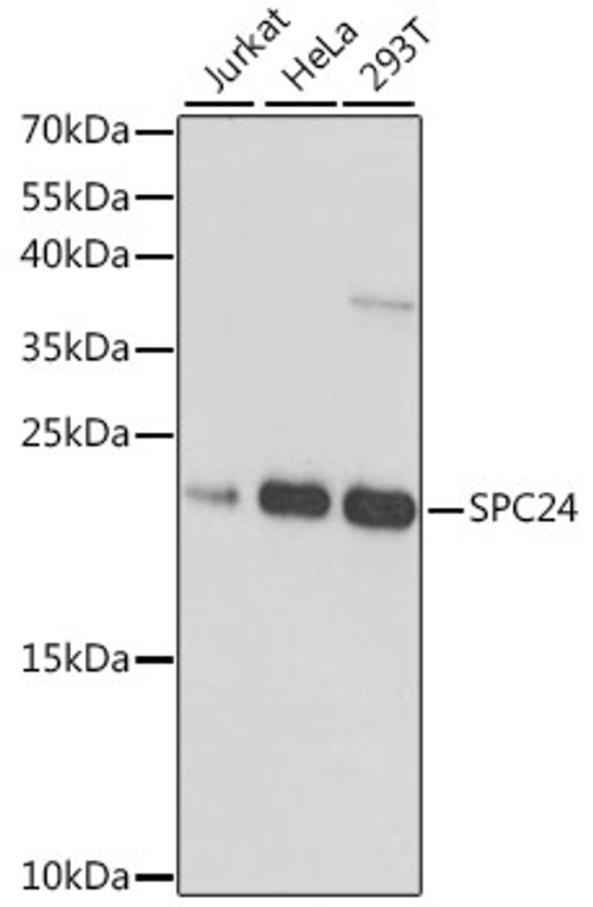 Western blot analysis of extracts of various cell lines using SPC24 Polyclonal Antibody at dilution of 1:1000.