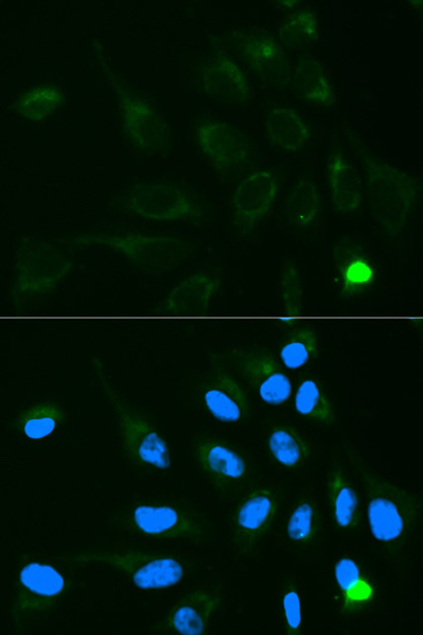 Immunofluorescence analysis of MCF-7 cells using UGT1A9 Polyclonal Antibody