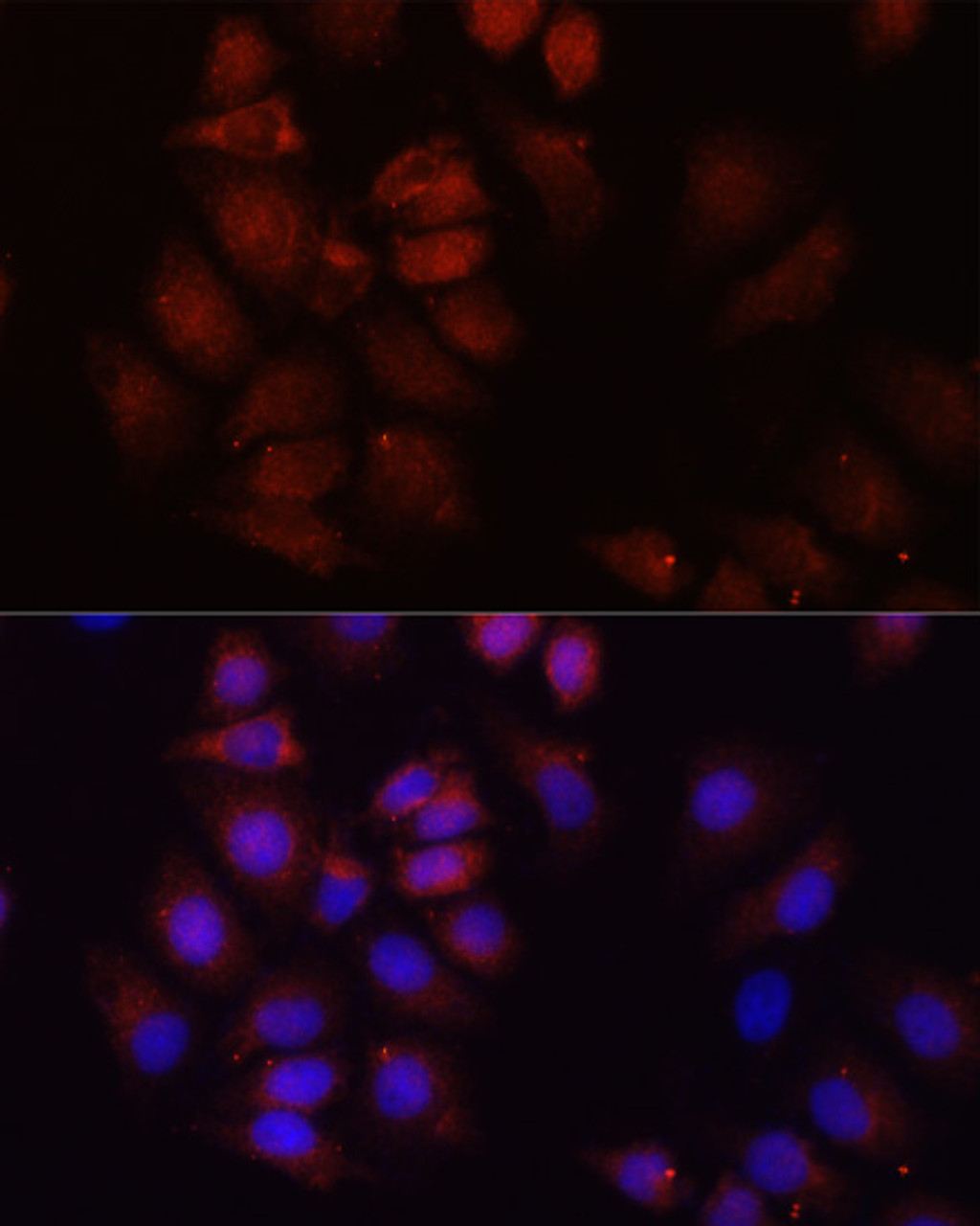 Immunofluorescence analysis of HeLa cells using HRNR Polyclonal Antibody at dilution of  1:100 (40x lens). Blue: DAPI for nuclear staining.