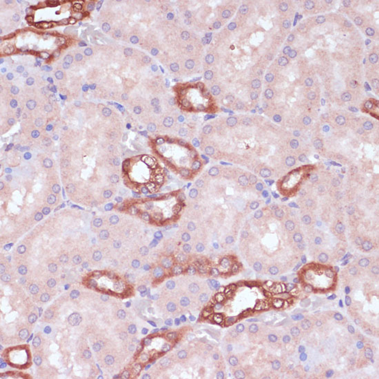 Immunohistochemistry of paraffin-embedded Rat kidney using UGT2B15 Polyclonal Antibody at dilution of  1:100 (40x lens).