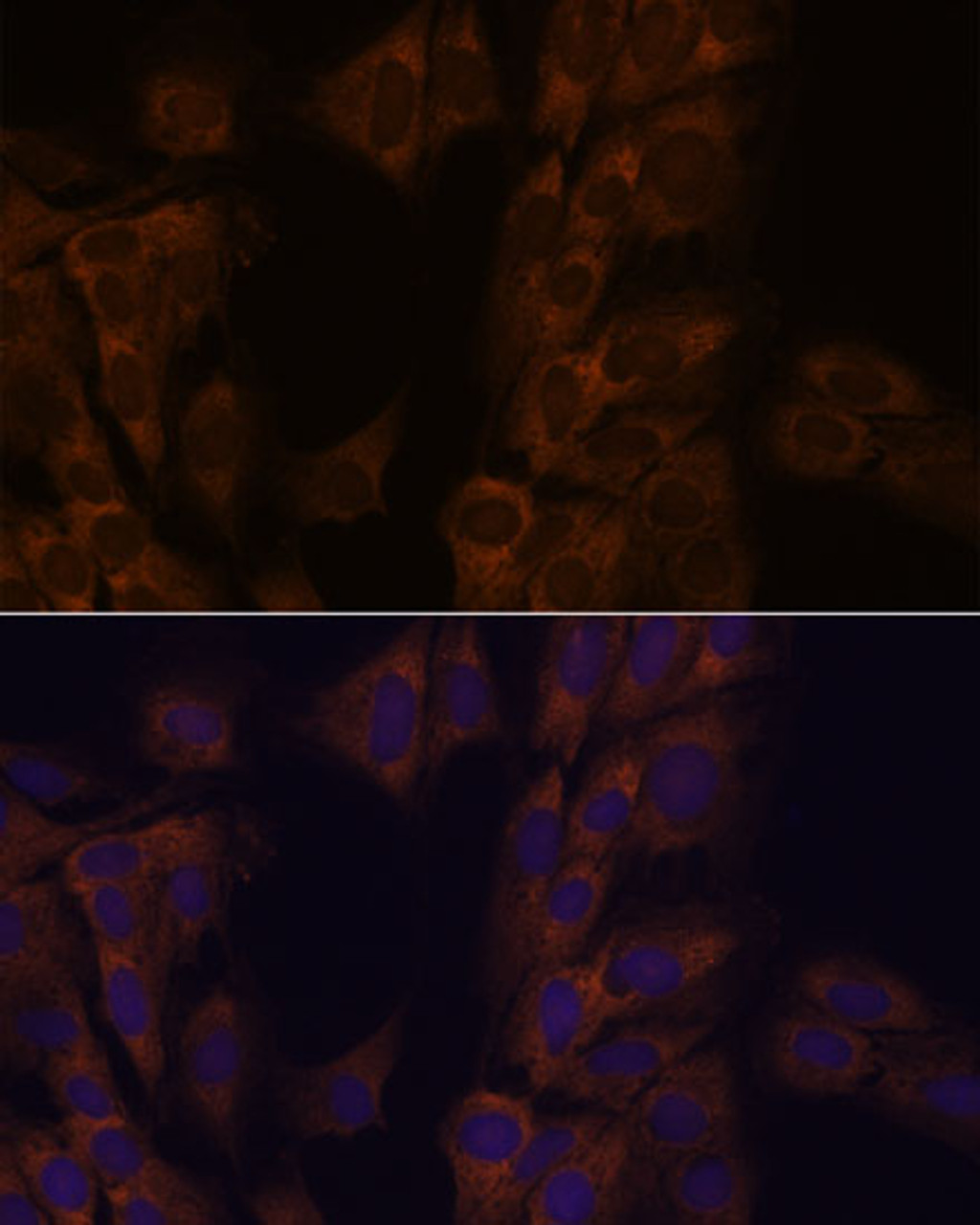 Immunofluorescence analysis of C6 cells using ATXN2 Polyclonal Antibody at dilution of  1:100. Blue: DAPI for nuclear staining.