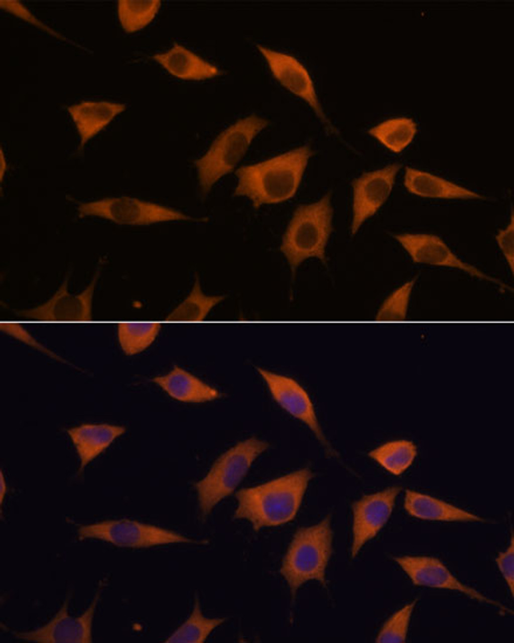 Immunofluorescence analysis of L929 cells using ATXN2 Polyclonal Antibody at dilution of  1:100. Blue: DAPI for nuclear staining.