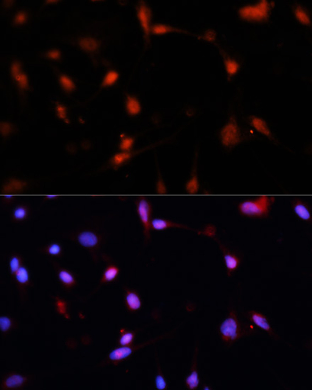 Immunofluorescence analysis of C6 cells using ESR1 Polyclonal Antibody at dilution of  1:100. Blue: DAPI for nuclear staining.