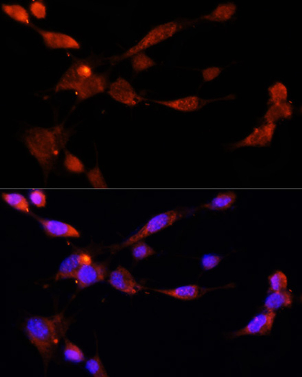 Immunofluorescence analysis of NIH/3T3 cells using ESR1 Polyclonal Antibody at dilution of  1:100. Blue: DAPI for nuclear staining.