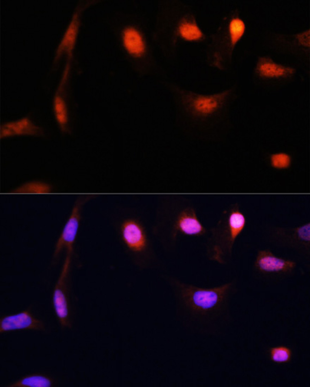Immunofluorescence analysis of U-2OS cells using ESR1 Polyclonal Antibody at dilution of  1:100. Blue: DAPI for nuclear staining.