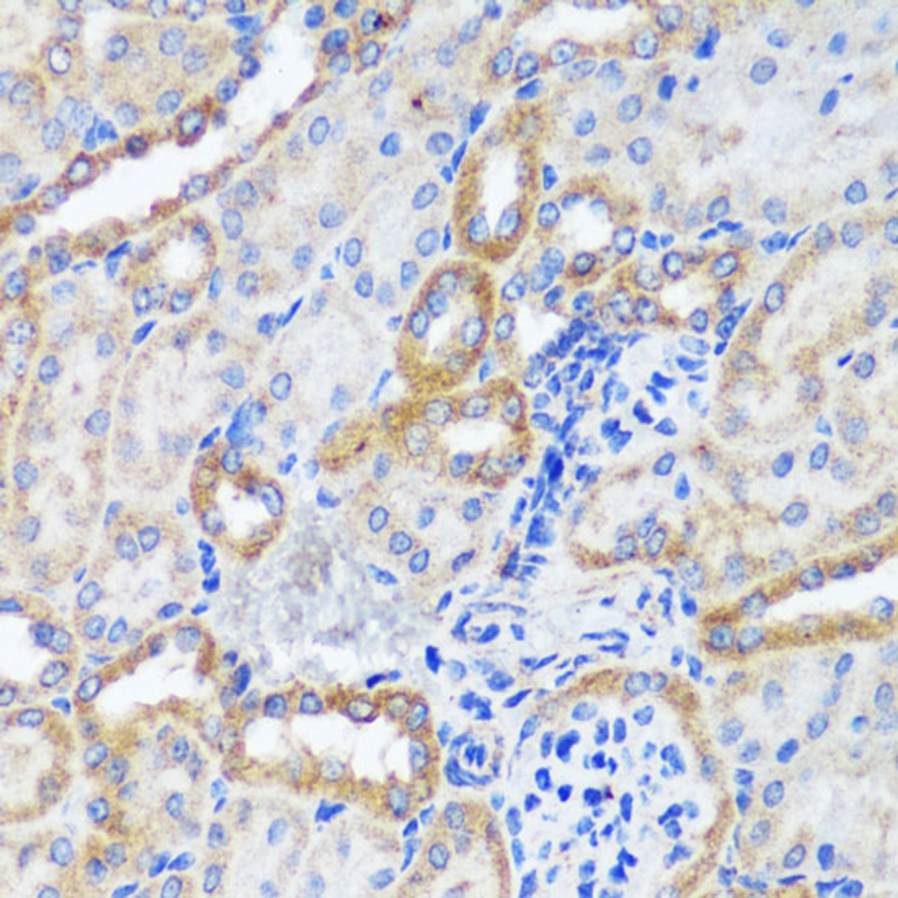 Immunohistochemistry of paraffin-embedded Mouse kidney using ERK1 / ERK2 Polyclonal Antibody at dilution of  1:200 (40x lens).