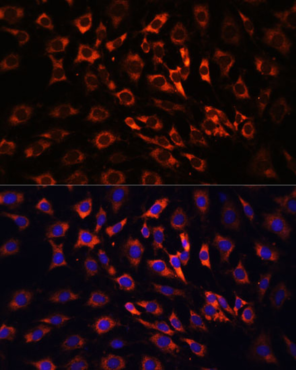 Immunofluorescence analysis of C6 cells using ERK1 / ERK2 Polyclonal Antibody at dilution of  1:100 (40x lens). Blue: DAPI for nuclear staining.