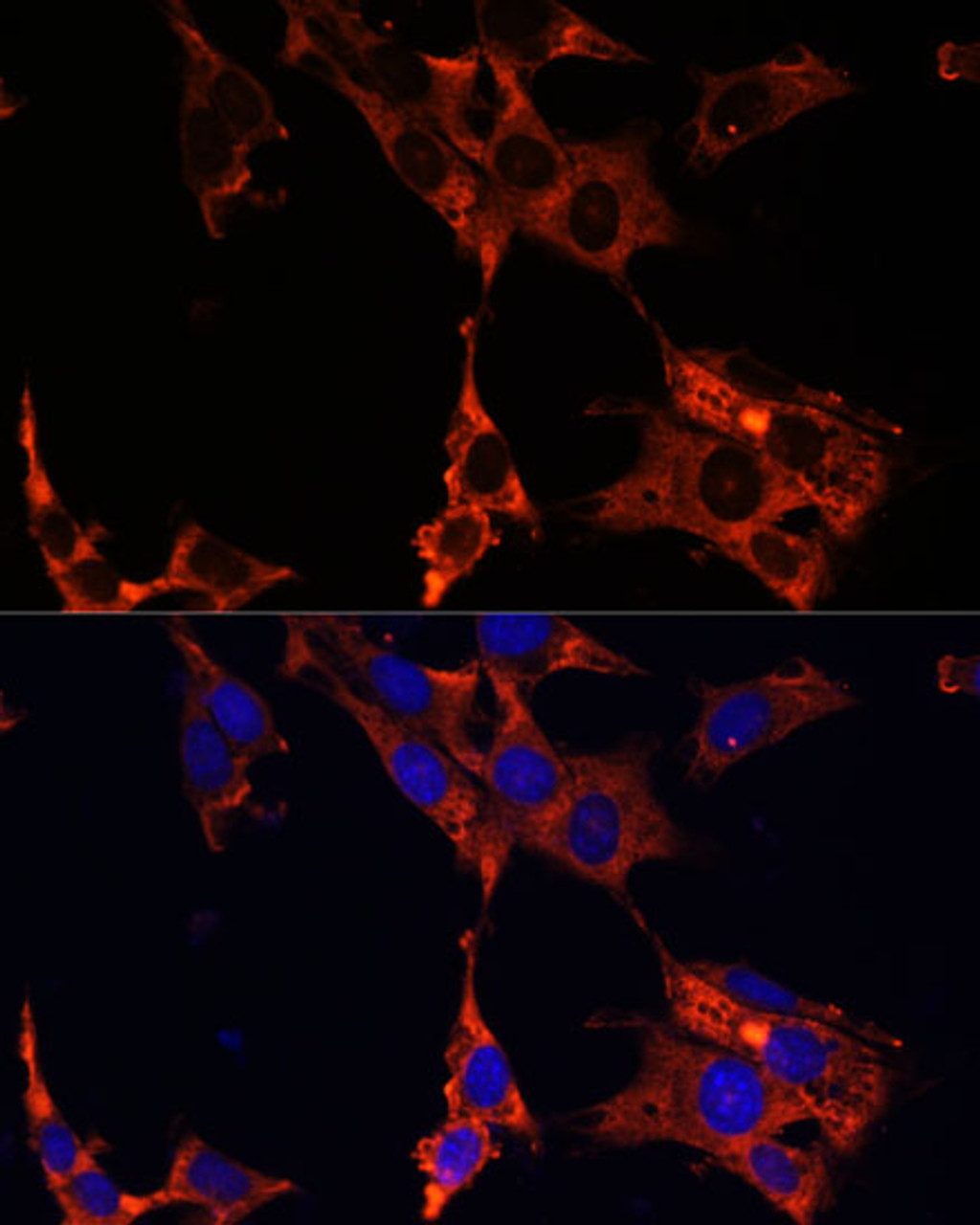 Immunofluorescence analysis of NIH-3T3 cells using ERK1 / ERK2 Polyclonal Antibody at dilution of  1:100 (40x lens). Blue: DAPI for nuclear staining.