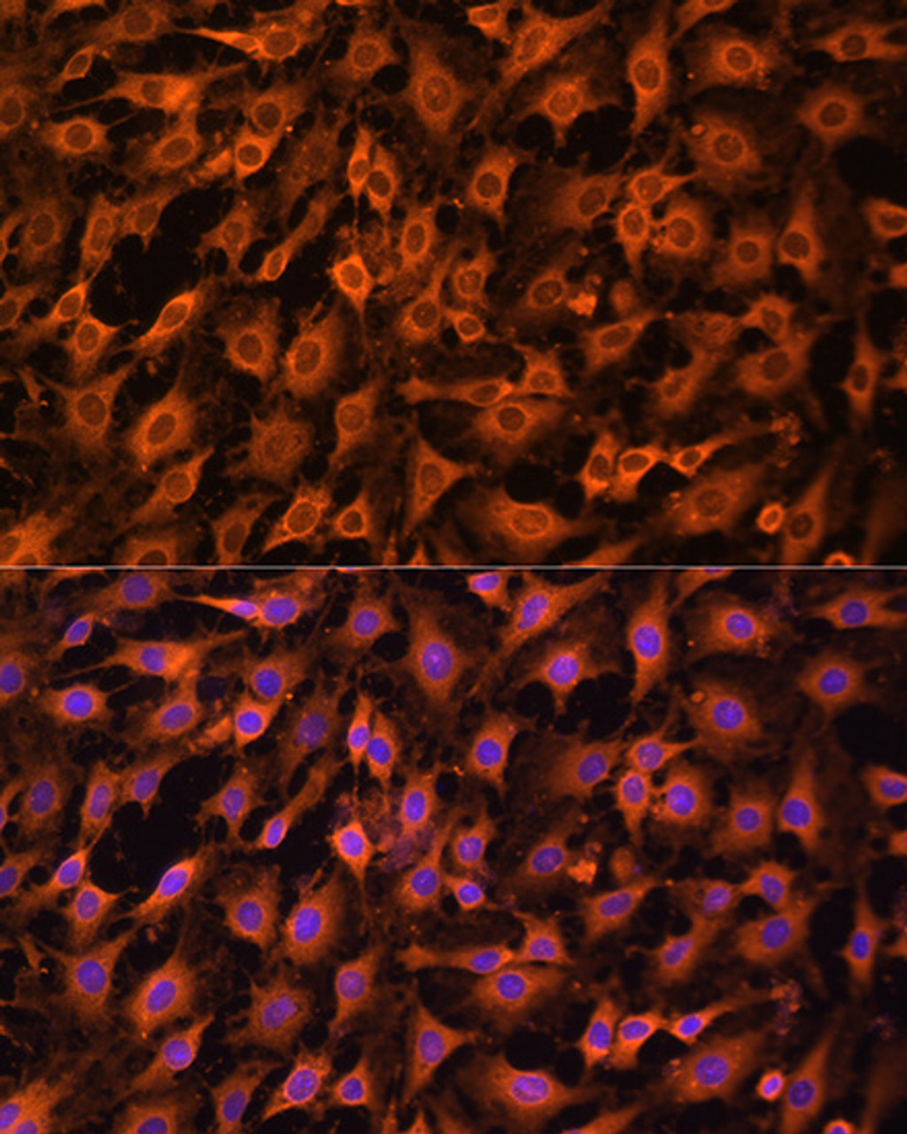 Immunofluorescence analysis of C6 cells using ERK1 / ERK2 Polyclonal Antibody at dilution of  1:100. Blue: DAPI for nuclear staining.