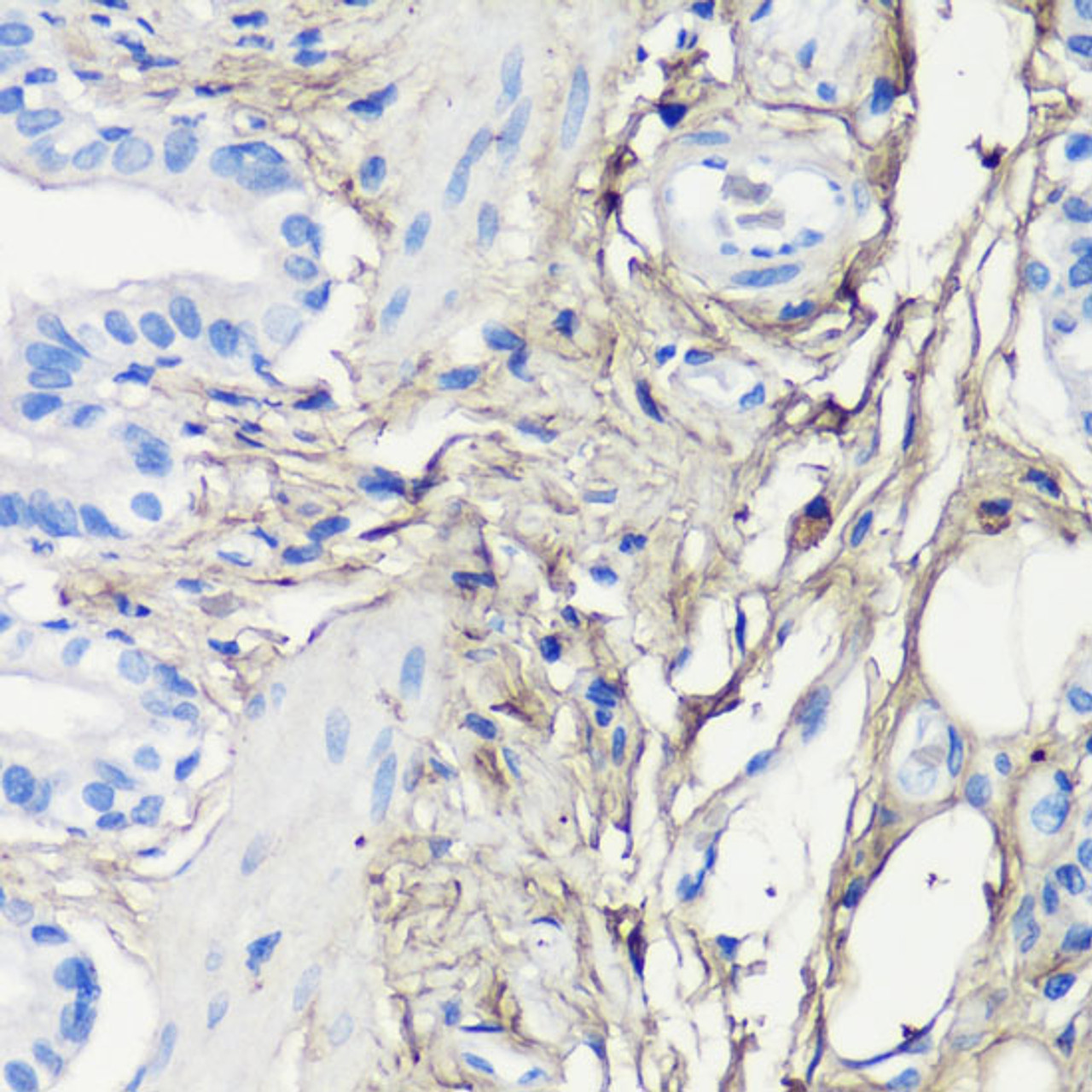 Immunohistochemistry of paraffin-embedded Rat lung using Decorin Polyclonal Antibody at dilution of  1:200 (40x lens).