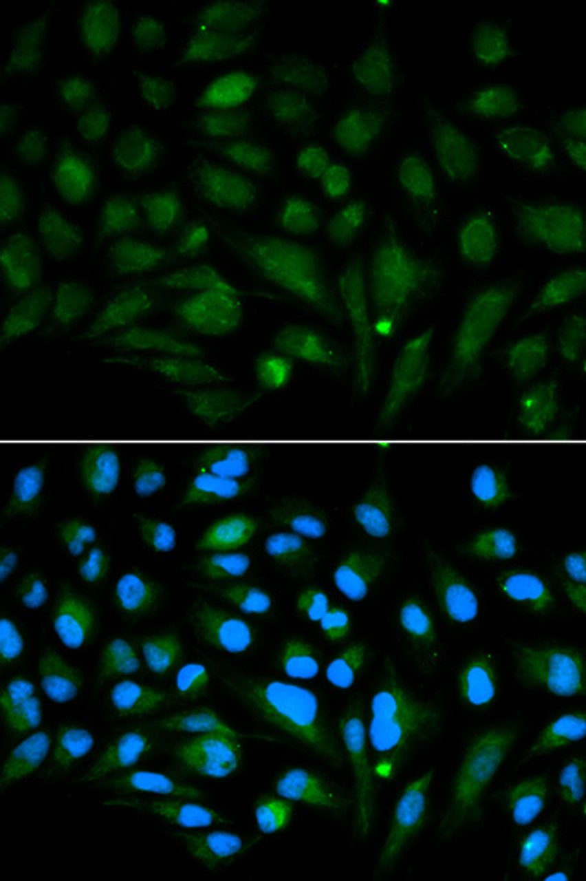 Immunofluorescence analysis of MCF-7 cells using Decorin Polyclonal Antibody