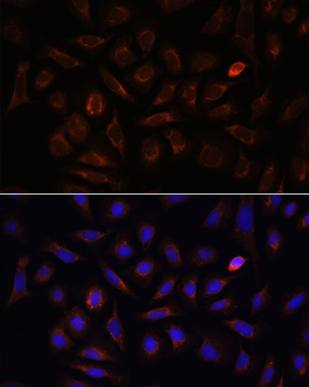 Immunofluorescence analysis of U-2 OS cells using NRP1 Polyclonal Antibody at dilution of  1:100. Blue: DAPI for nuclear staining.