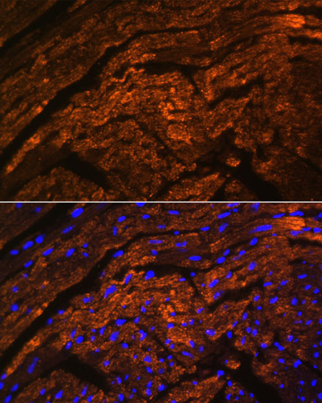 Immunofluorescence analysis of Rat heart using TTN Polyclonal Antibody at dilution of  1:100. Blue: DAPI for nuclear staining.