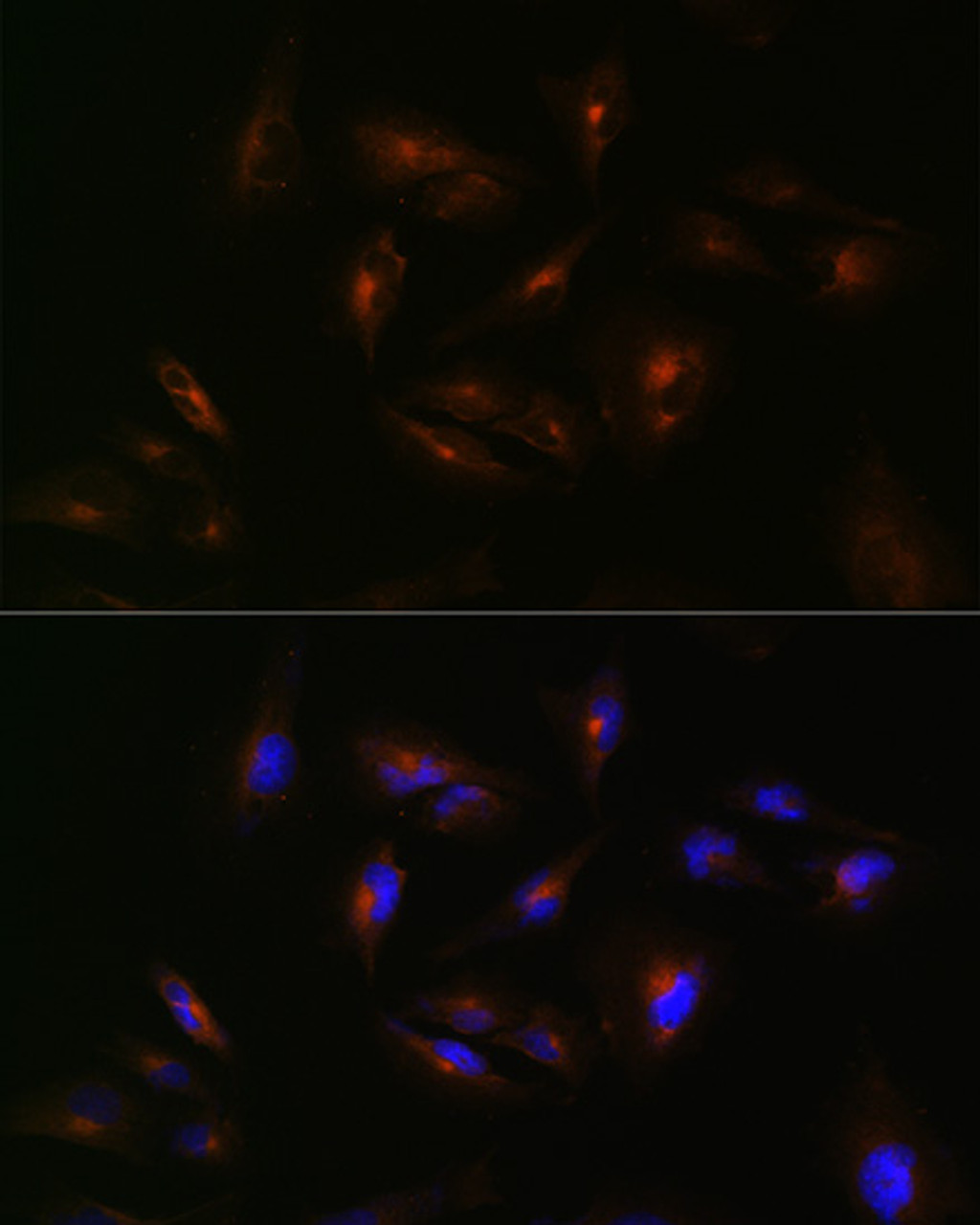 Immunofluorescence analysis of U-251 MG cells using ABCA2 Polyclonal Antibody at dilution of  1:100 (40x lens). Blue: DAPI for nuclear staining.