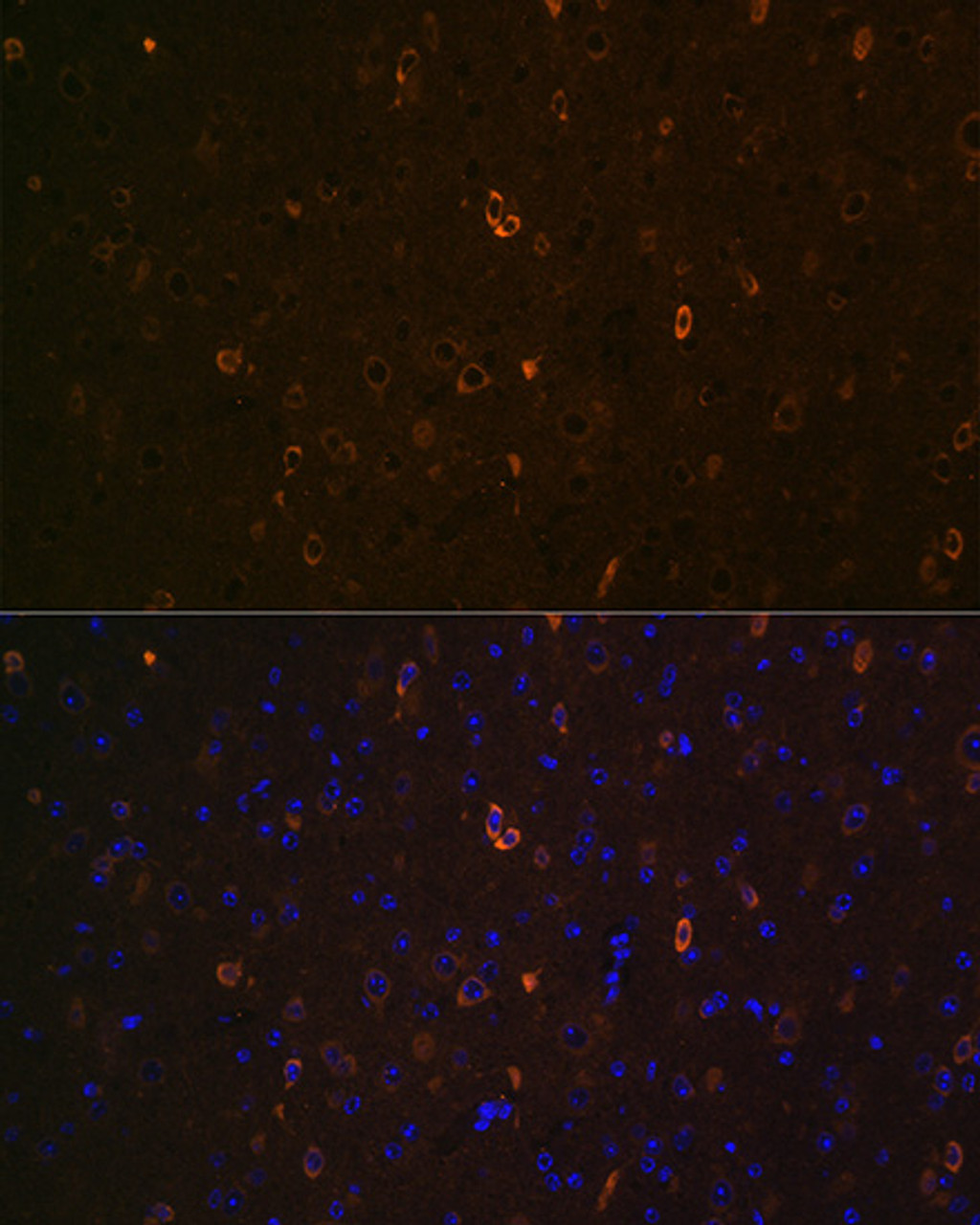 Immunofluorescence analysis of Mouse brain using ABCA2 Polyclonal Antibody at dilution of  1:100 (40x lens). Blue: DAPI for nuclear staining.