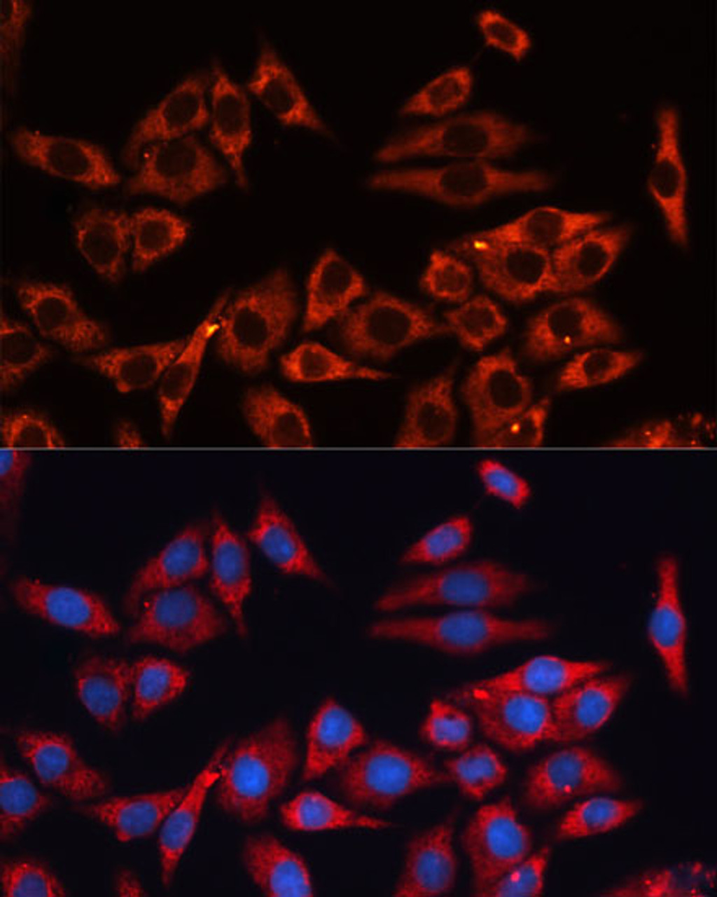 Immunofluorescence analysis of HeLa cells using MAPK1/MAPK3 Polyclonal Antibody at dilution of  1:100 (40x lens). Blue: DAPI for nuclear staining.