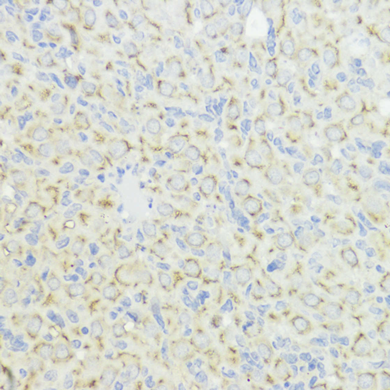 Immunohistochemistry of paraffin-embedded Rat ovary using CCNB1 Polyclonal Antibody at dilution of  1:100 (40x lens).