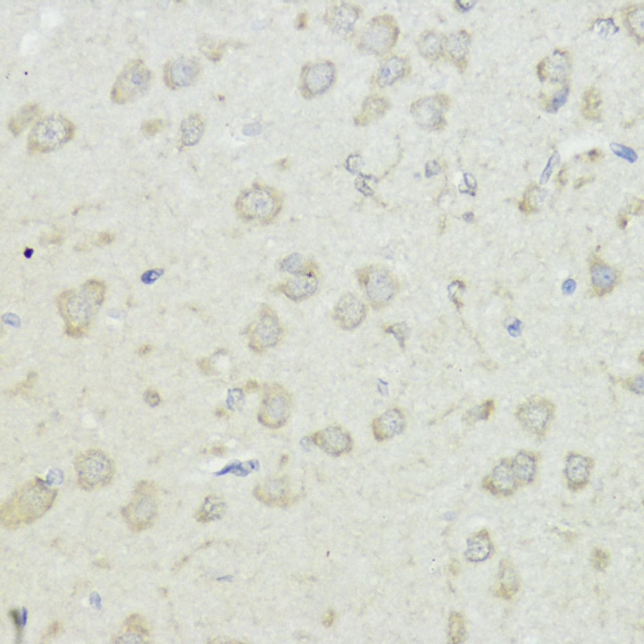Immunohistochemistry of paraffin-embedded Rat brain using CCNB1 Polyclonal Antibody at dilution of  1:100 (40x lens).