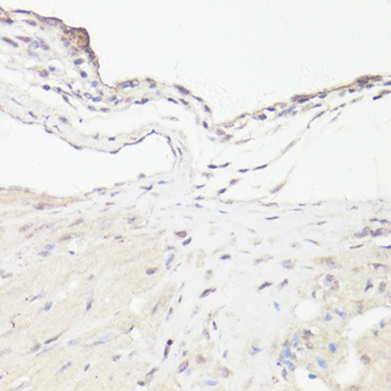 Immunohistochemistry of paraffin-embedded Mouse heart using DMP1 Polyclonal Antibody at dilution of  1:100 (40x lens).