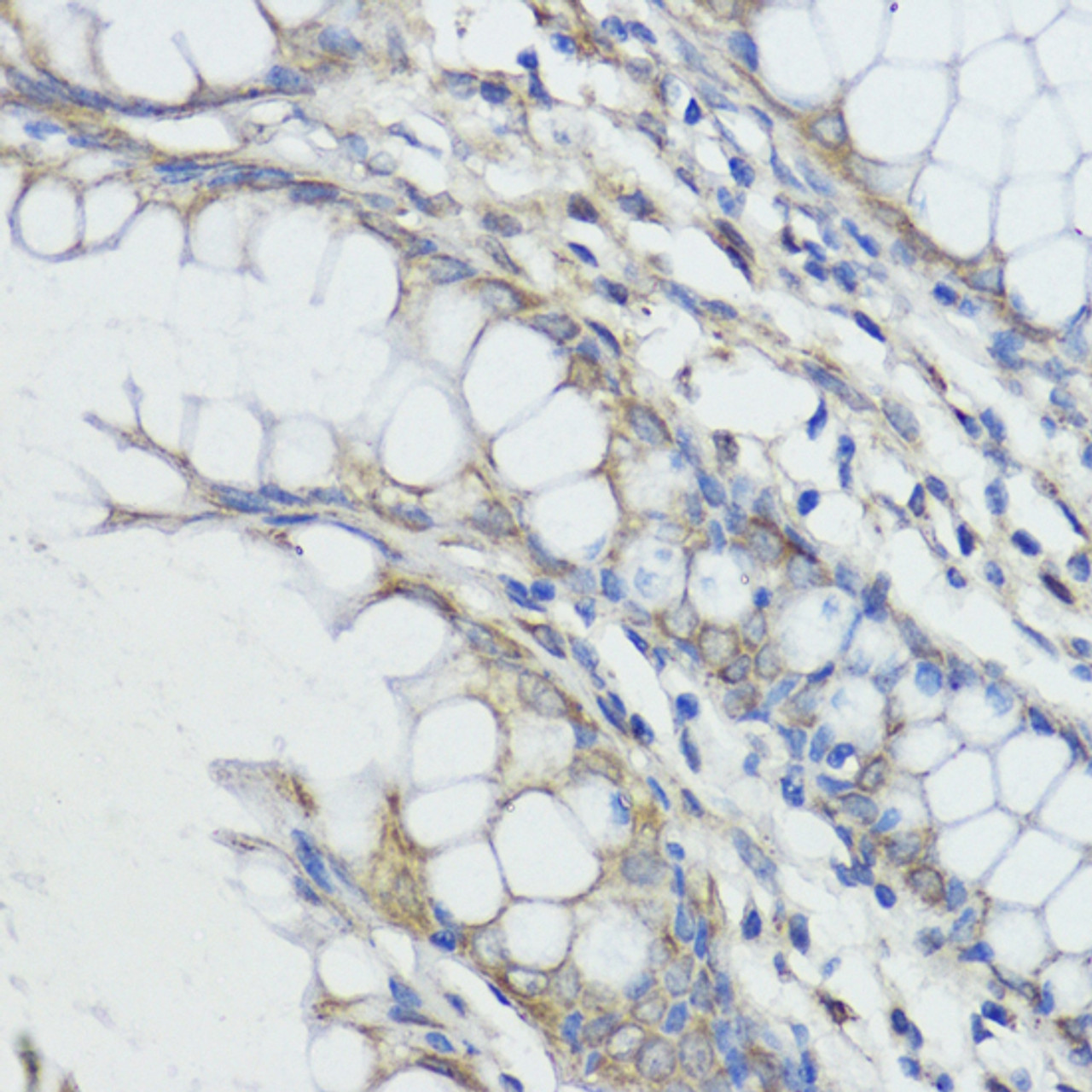 Immunohistochemistry of paraffin-embedded Human colon using FXN Polyclonal Antibody at dilution of  1:100 (40x lens).