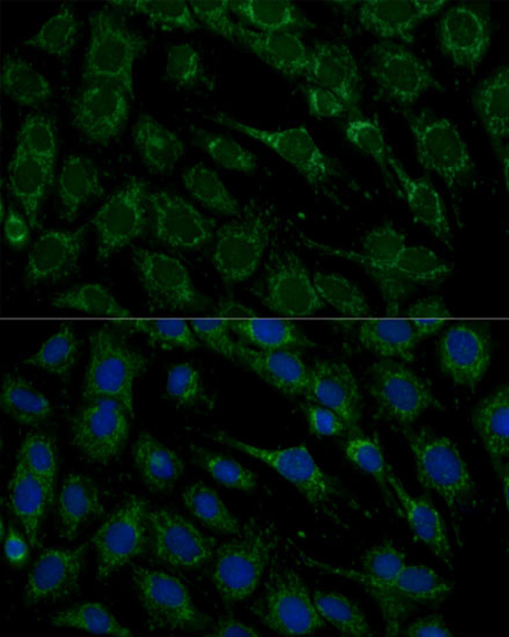 Immunofluorescence analysis of C6 cells using FXN Polyclonal Antibody at dilution of  1:100. Blue: DAPI for nuclear staining.