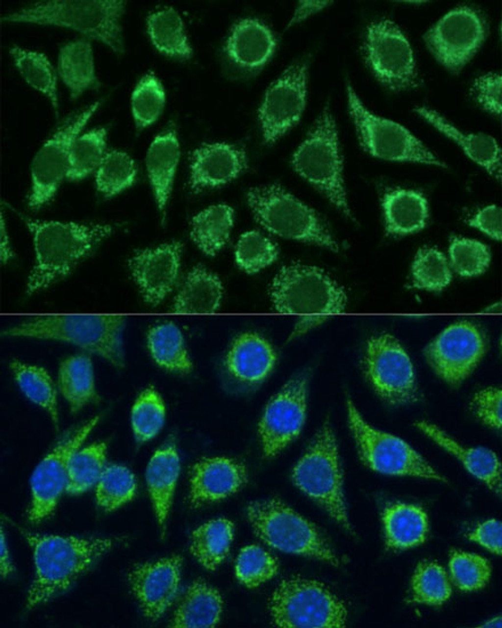 Immunofluorescence analysis of L929 cells using FXN Polyclonal Antibody at dilution of  1:100. Blue: DAPI for nuclear staining.
