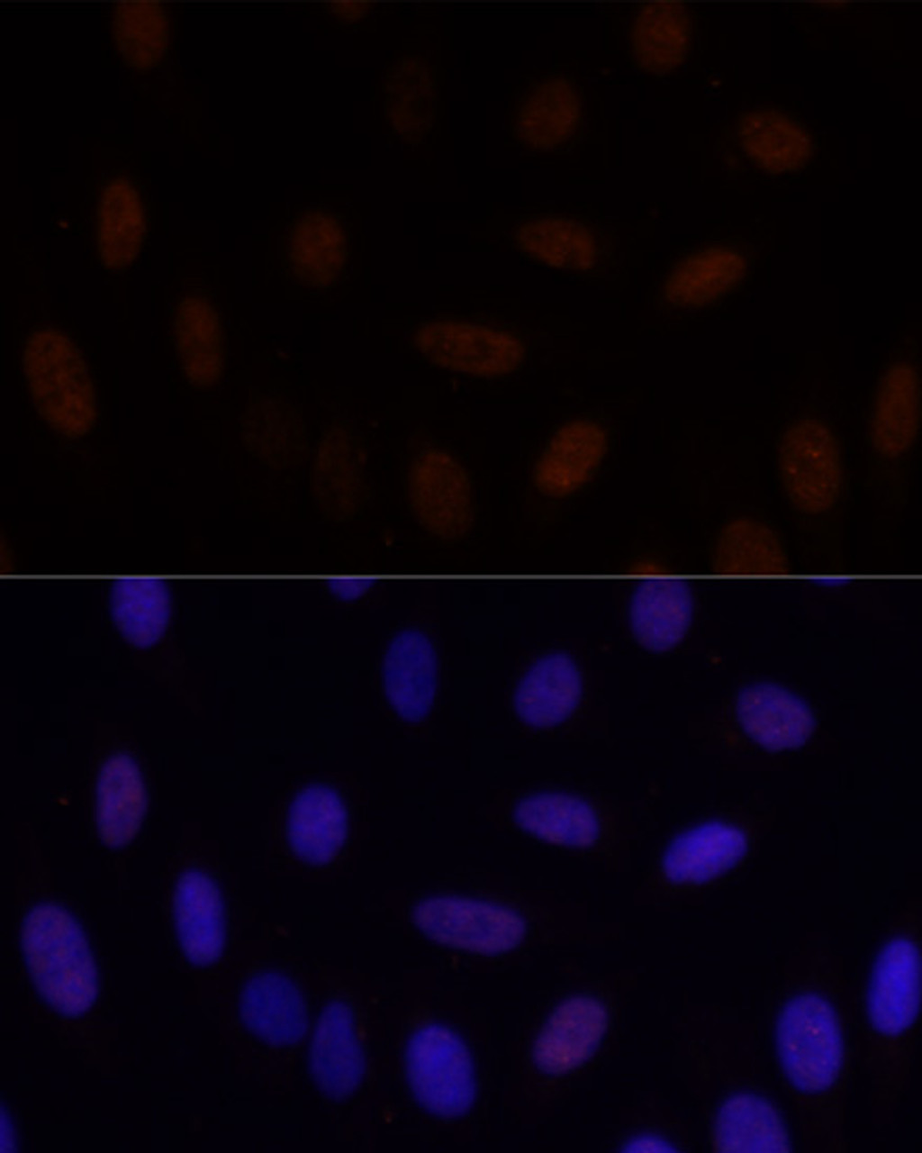 Immunofluorescence analysis of U-2 OS cells using GLI2 Polyclonal Antibody at dilution of  1:100. Blue: DAPI for nuclear staining.