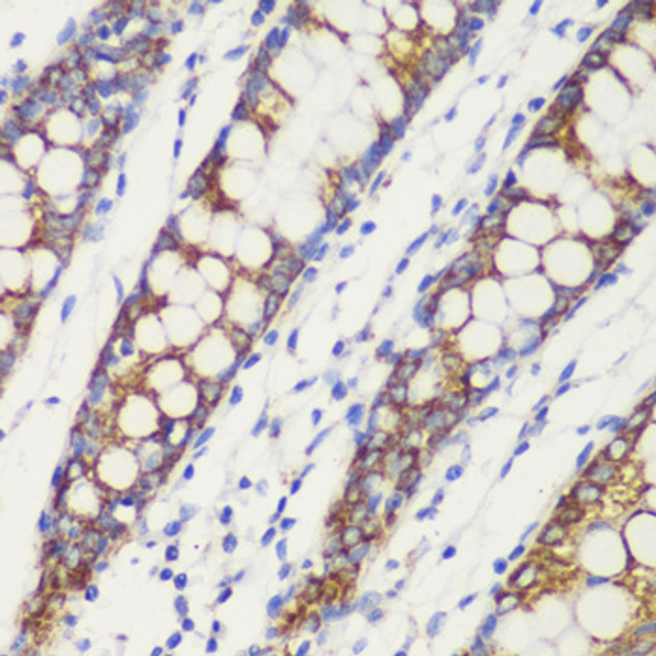 Immunohistochemistry of paraffin-embedded Human colon using TOM20 Polyclonal Antibody at dilution of  1:100 (40x lens).