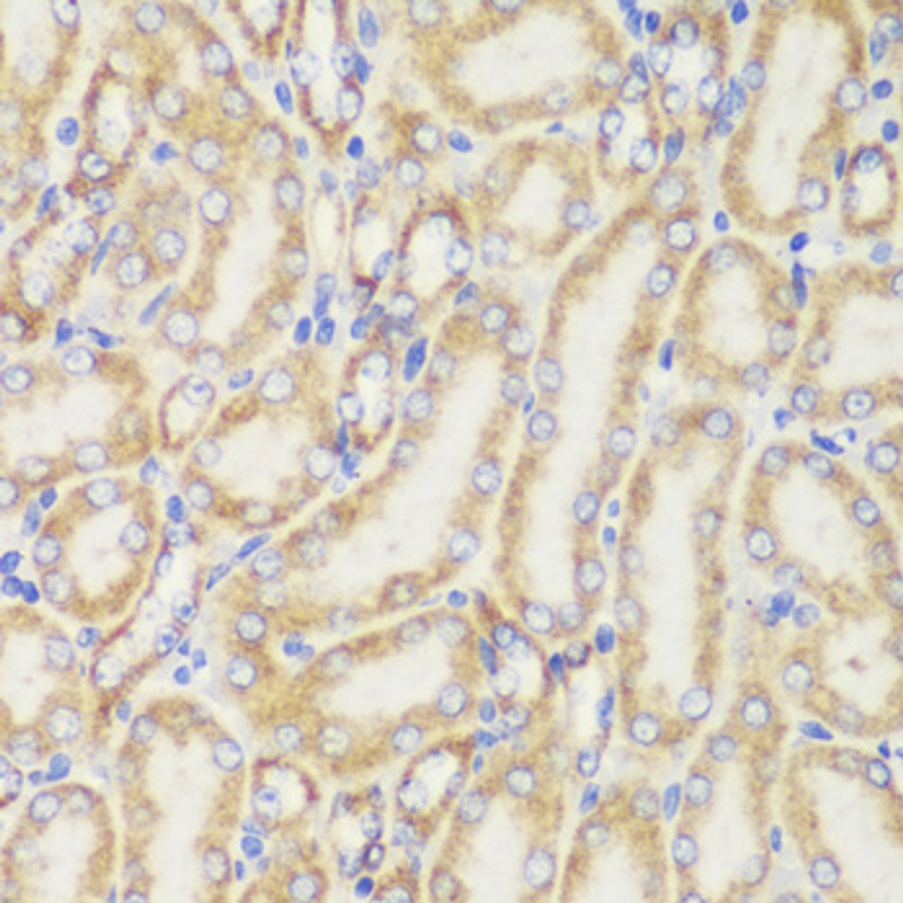 Immunohistochemistry of paraffin-embedded Mouse kidney using TOM20 Polyclonal Antibody at dilution of  1:100 (40x lens).
