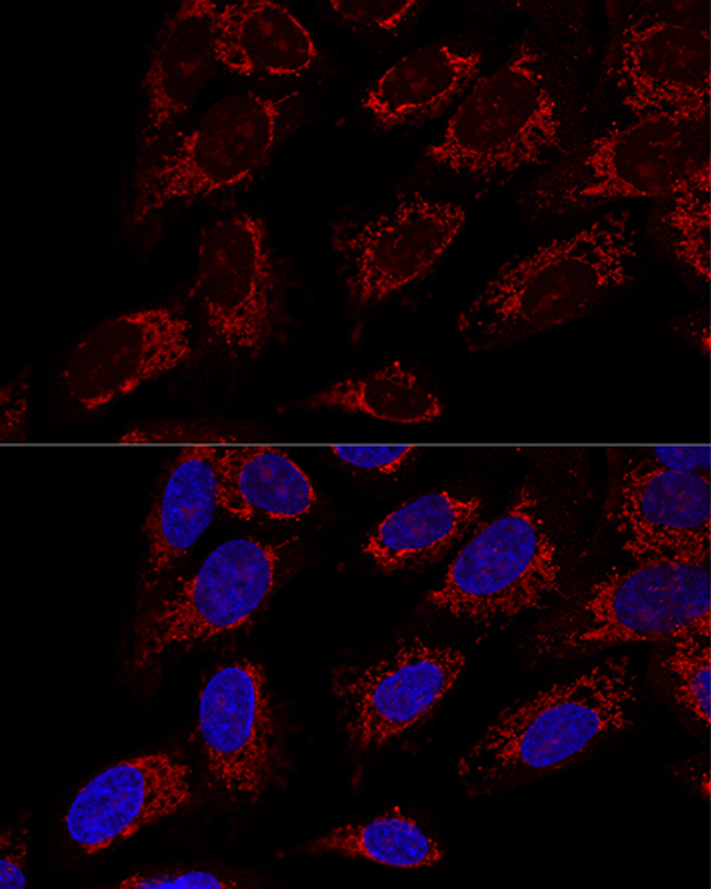 Confocal immunofluorescence analysis of U2OS cells using TOM20 Polyclonal Antibody at dilution of  1:100. Blue: DAPI for nuclear staining.