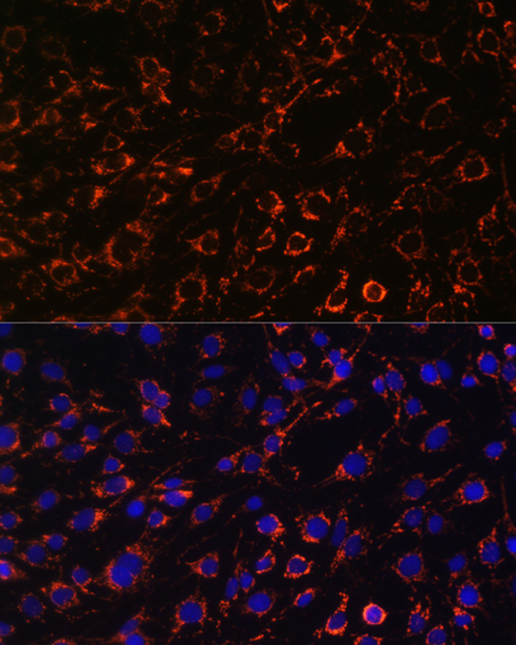 Immunofluorescence analysis of C6 cells using TOM20 Polyclonal Antibody at dilution of  1:100. Blue: DAPI for nuclear staining.