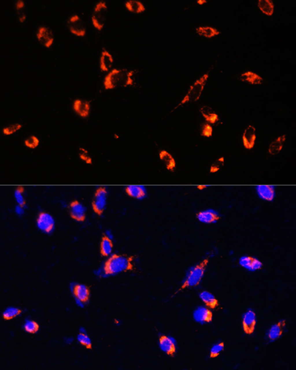 Immunofluorescence analysis of NIH/3T3 using TOM20 Polyclonal Antibody at dilution of  1:100. Blue: DAPI for nuclear staining.