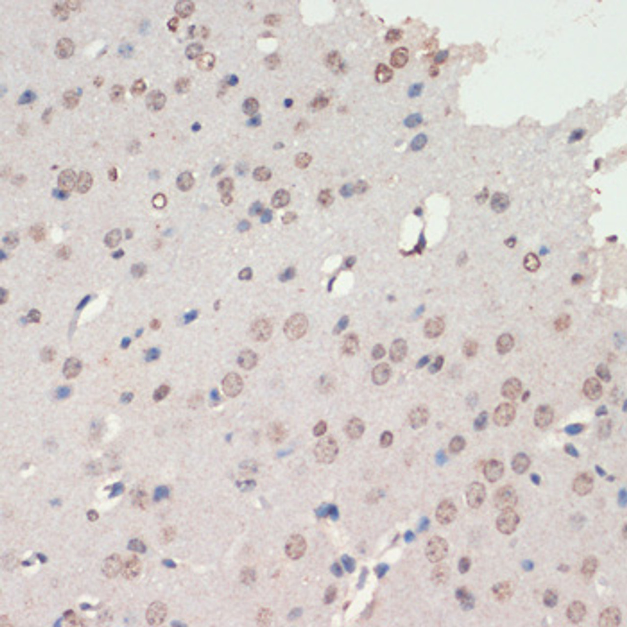 Immunohistochemistry of paraffin-embedded Mouse brain using NEUROD1 Polyclonal Antibody at dilution of  1:200 (40x lens).