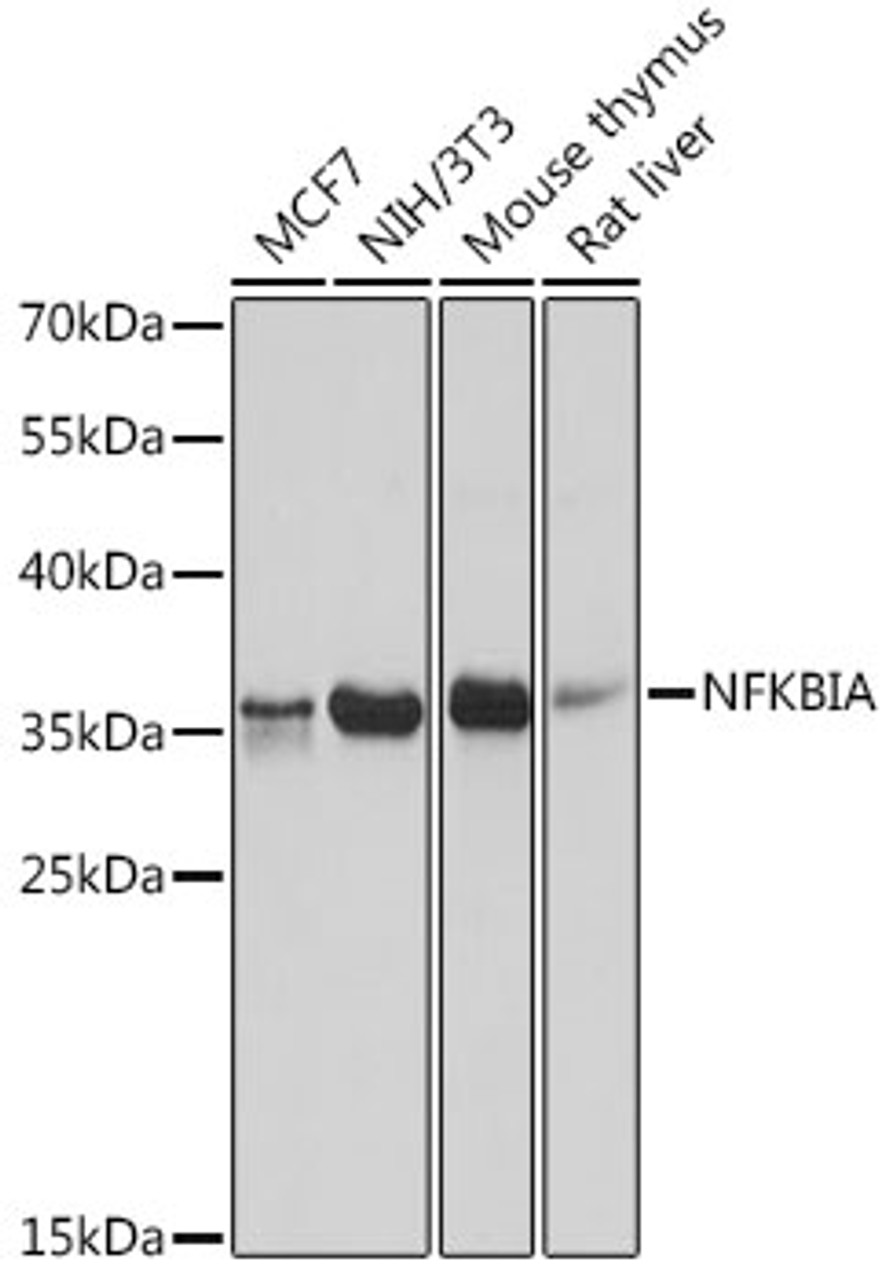 Western blot analysis of extracts of various cell lines using NFKBIA Polyclonal Antibody at dilution of 1:1000.