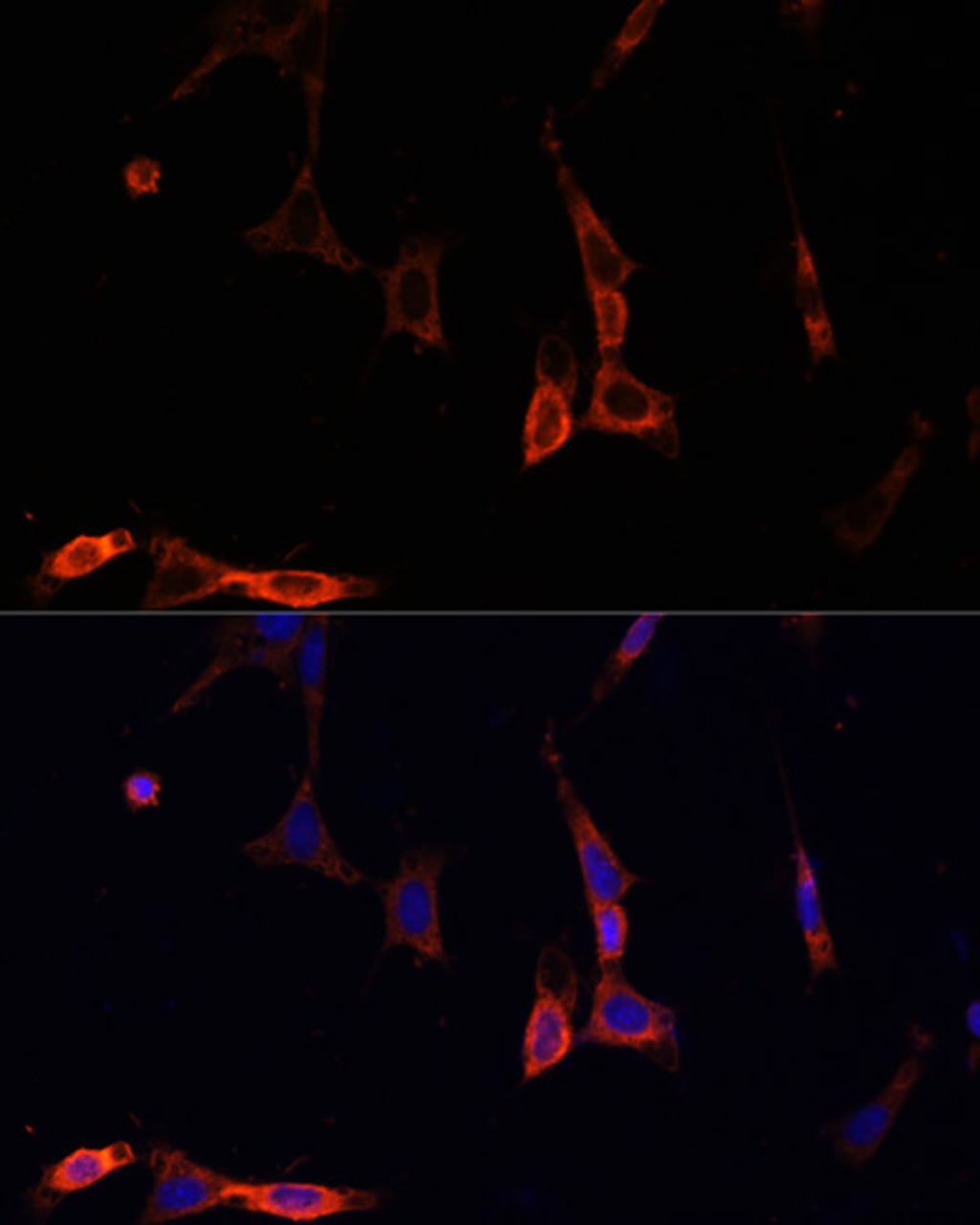 Immunofluorescence analysis of NIH/3T3 cells using NFKBIA Polyclonal Antibody at dilution of  1:100. Blue: DAPI for nuclear staining.