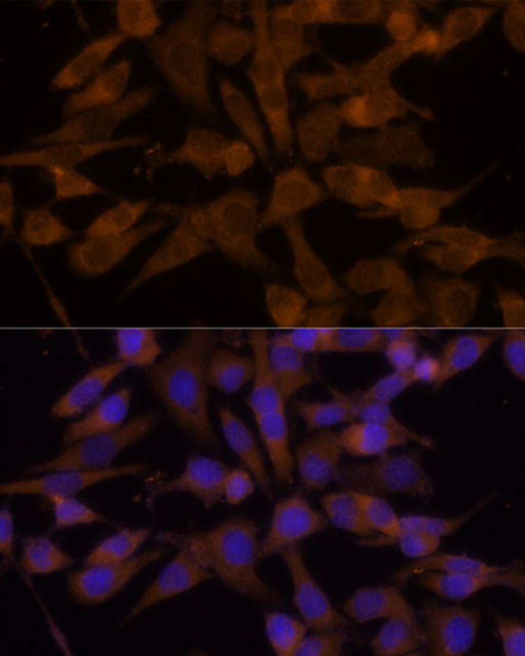 Immunofluorescence analysis of HeLa cells using UGT2B7 Polyclonal Antibody at dilution of  1:100 (40x lens). Blue: DAPI for nuclear staining.