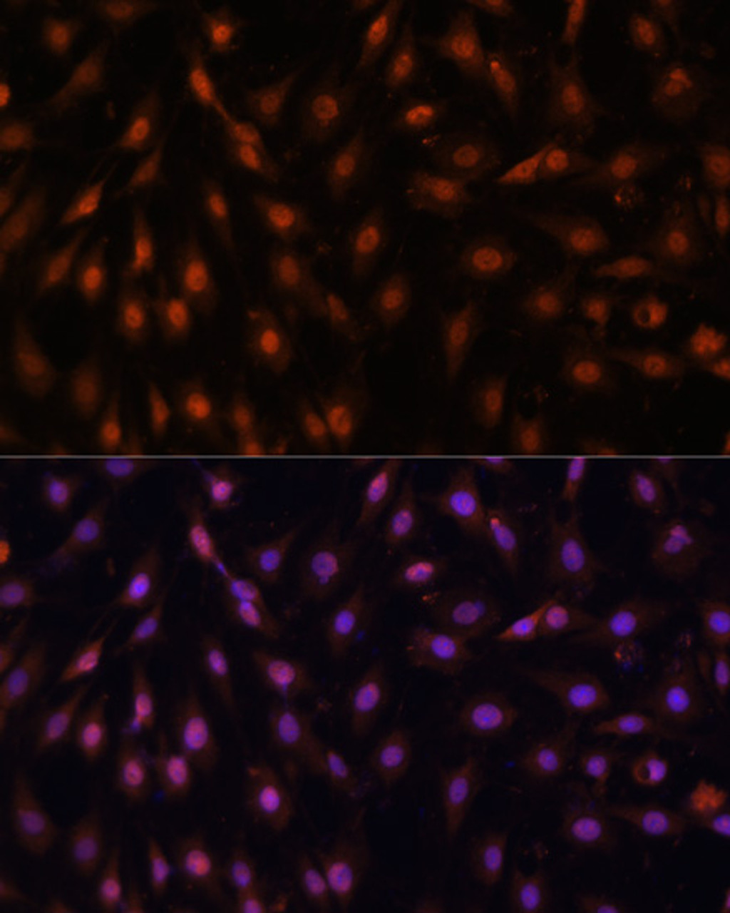 Immunofluorescence analysis of C6 cells using P70 S6K Polyclonal Antibody at dilution of  1:100. Blue: DAPI for nuclear staining.