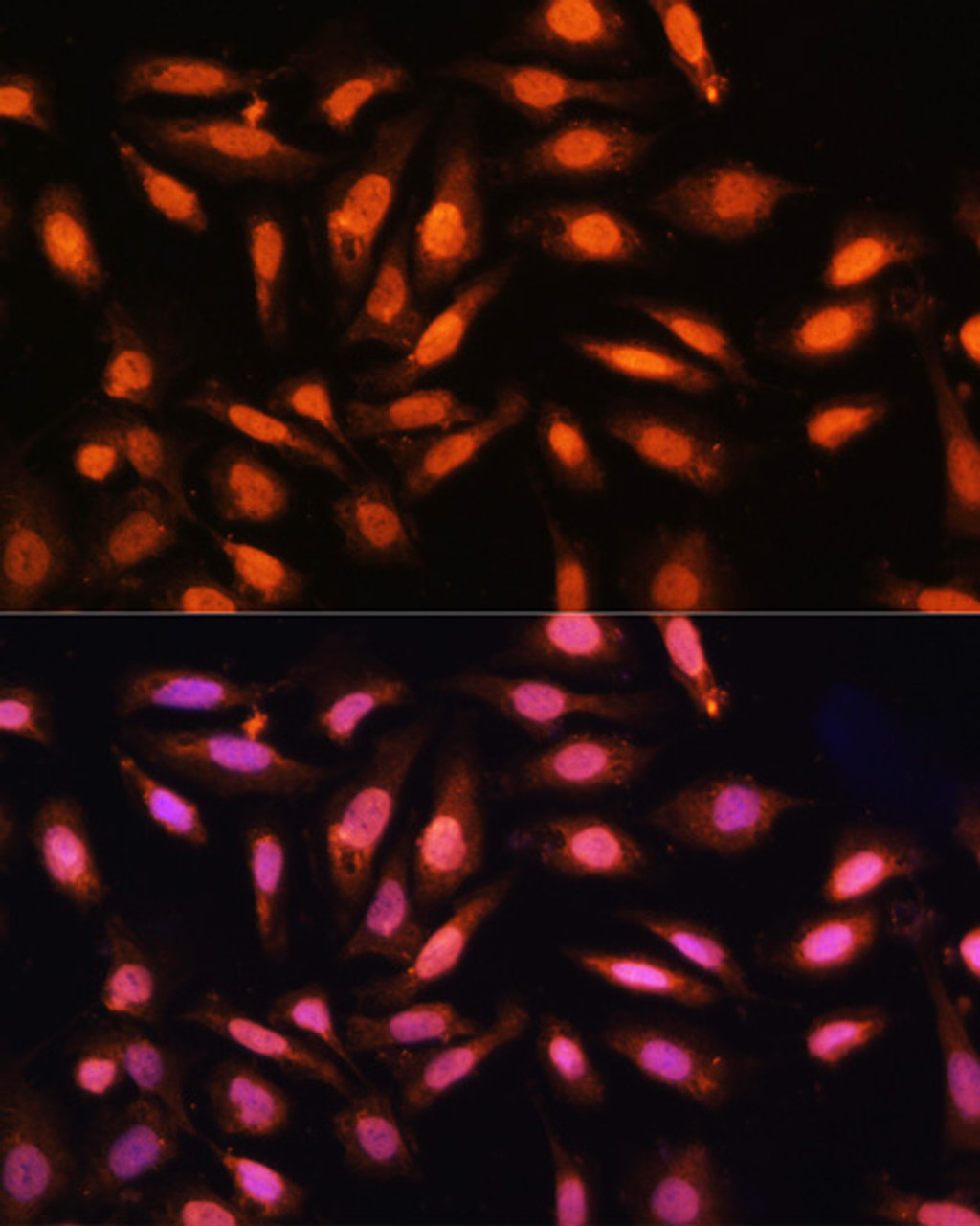 Immunofluorescence analysis of U2OS cells using P70 S6K Polyclonal Antibody at dilution of  1:100. Blue: DAPI for nuclear staining.