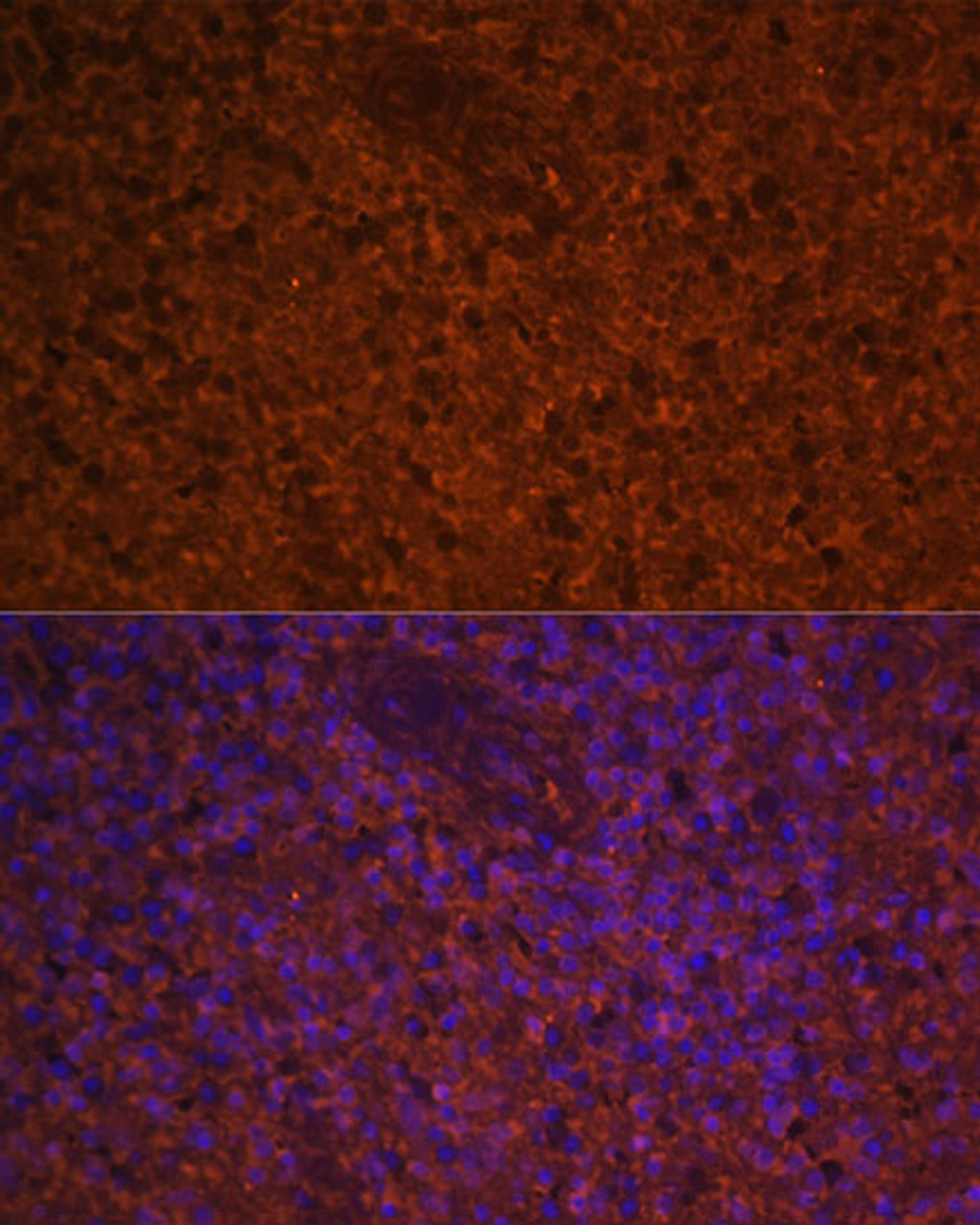 Immunofluorescence analysis of Human spleen using CCL19 Polyclonal Antibody at dilution of  1:100 (40x lens). Blue: DAPI for nuclear staining.