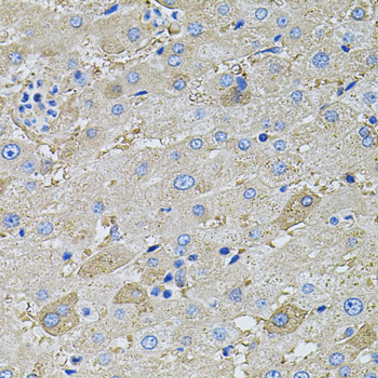 Immunohistochemistry of paraffin-embedded Human liver using GLA Polyclonal Antibody at dilution of  1:100 (40x lens).