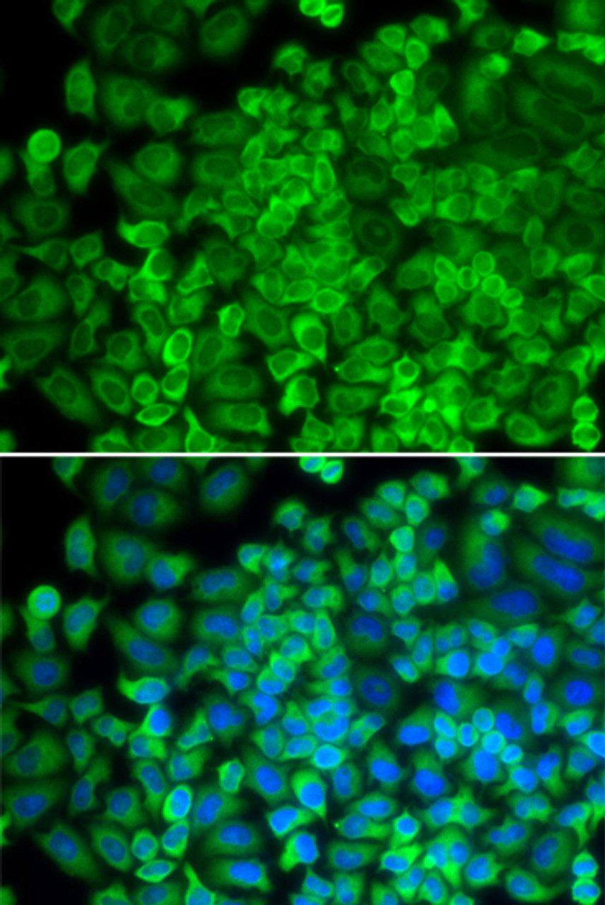 Immunofluorescence analysis of HeLa cells using GLA Polyclonal Antibody