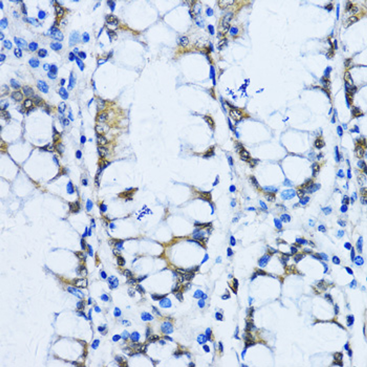 Immunohistochemistry of paraffin-embedded Human stomach using VIL1 Polyclonal Antibody at dilution of  1:100 (40x lens).