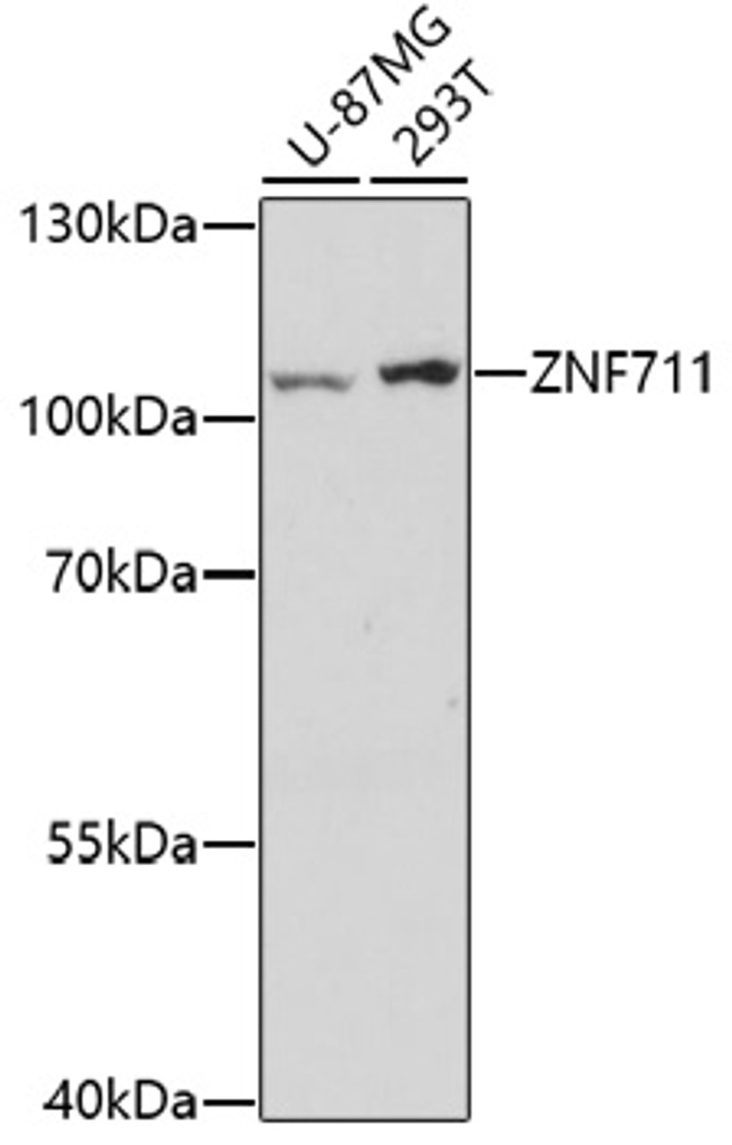 Western blot analysis of extracts of various cell lines using ZNF711 Polyclonal Antibody at dilution of 1:1000.