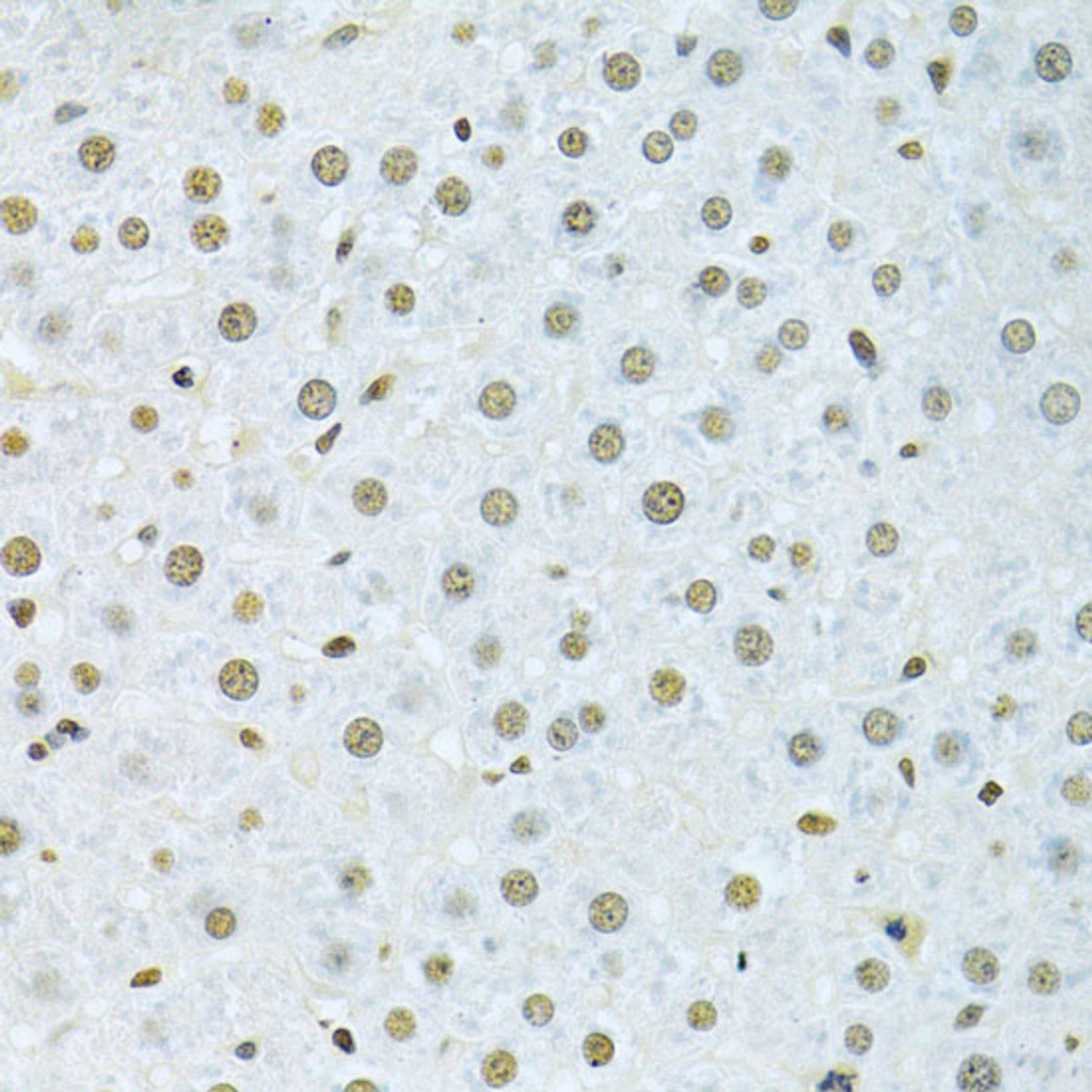 Immunohistochemistry of paraffin-embedded Rat liver using HNRNPK Polyclonal Antibody at dilution of  1:200 (40x lens).